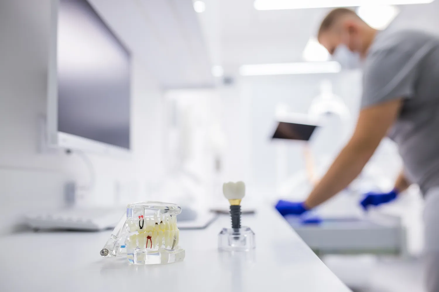 Ile kosztują wszystkie zęby implanty?