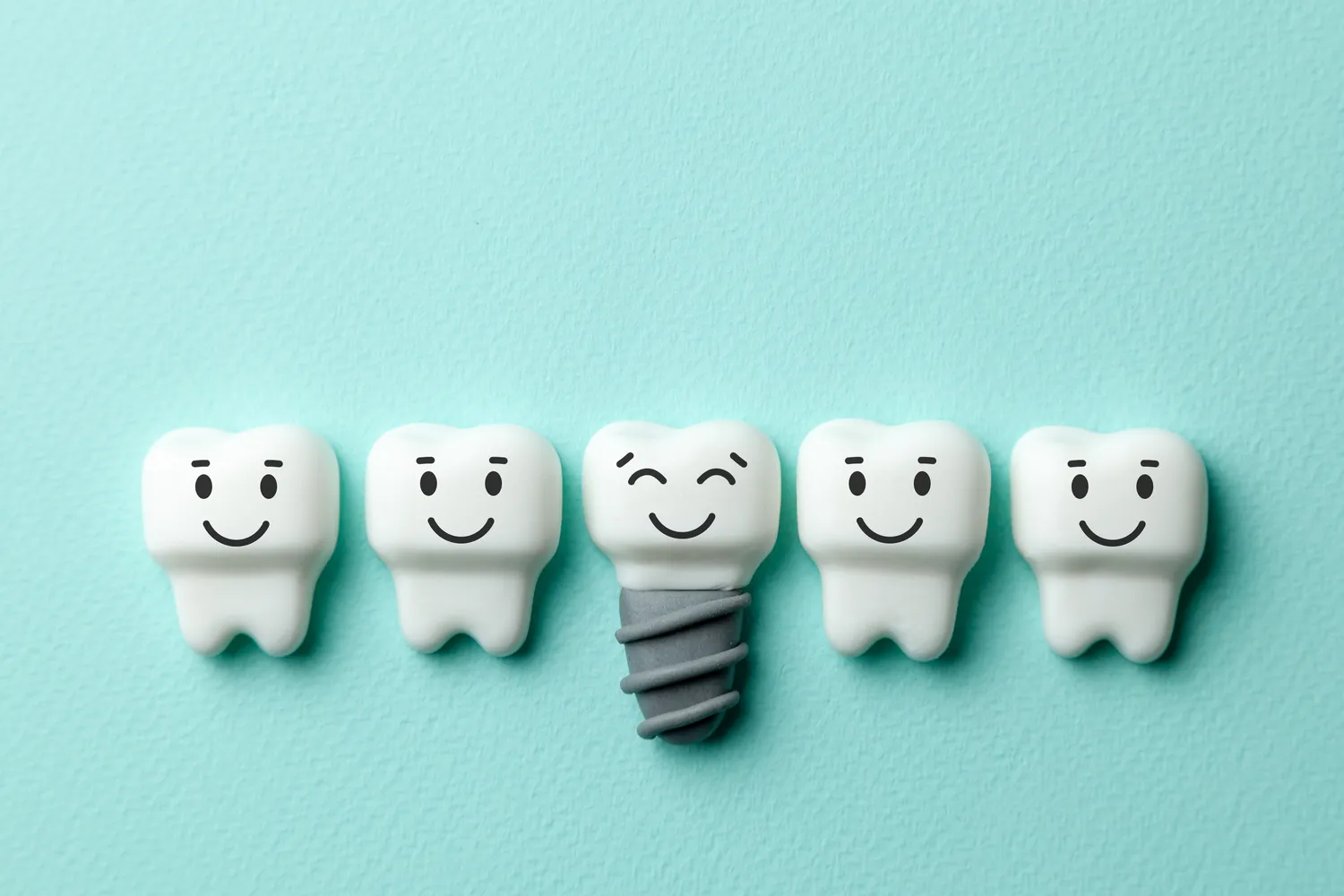 Zęby implanty - ile kosztują?