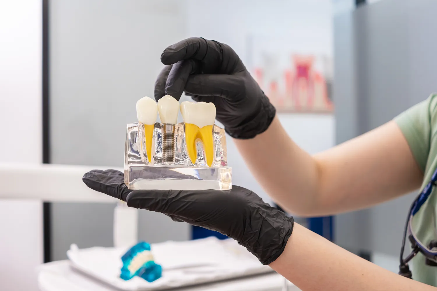 Implanty koszt Warszawa