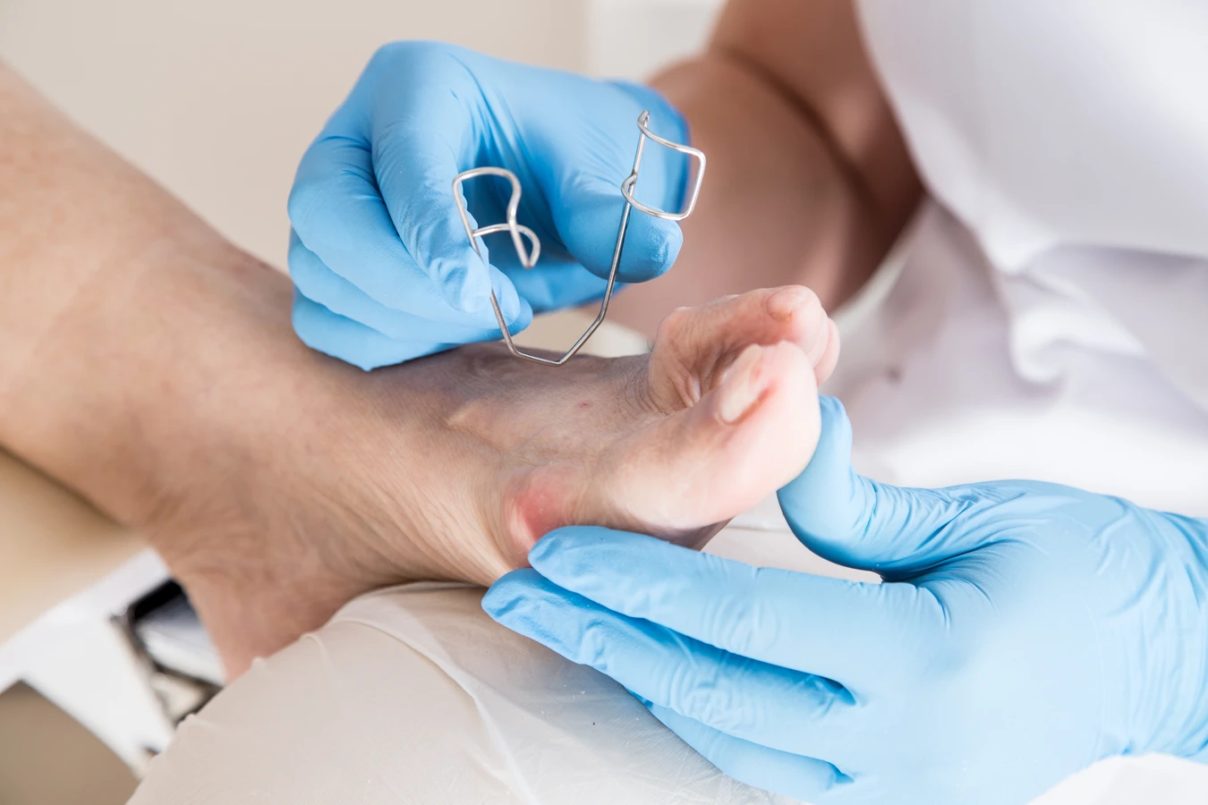 Podologia - pomoc dla stóp